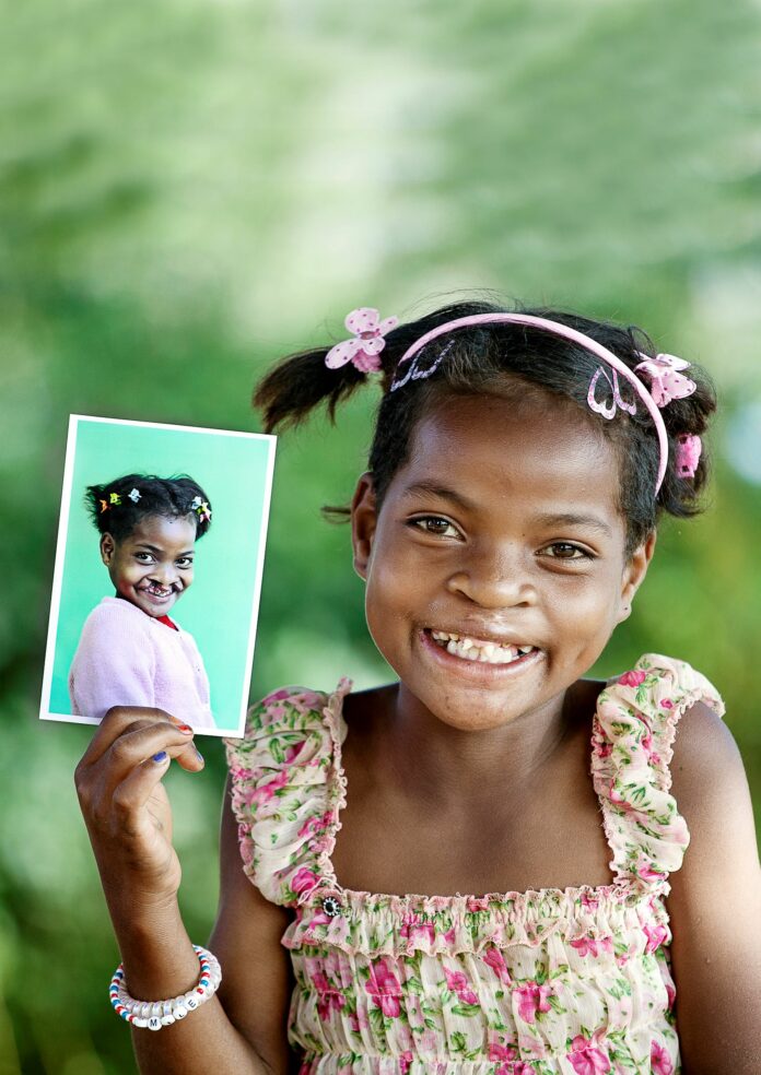 Operation Smile_Clara_Madagascar