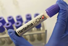 Per la diagnosi degli hantavirus esistono kit certificati